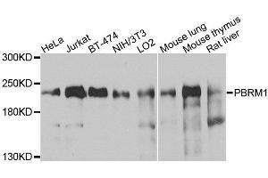 Western blot analysis of extracts of various cell lines, using PBRM1 antibody (ABIN6003610) at 1/1000 dilution. (Polybromo 1 anticorps)