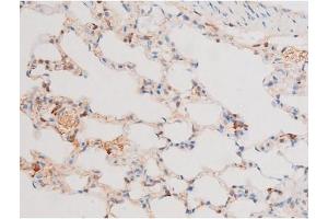 ABIN6267579 at 1/200 staining Rat lung tissue sections by IHC-P.