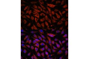 Immunofluorescence analysis of L929 cells using STK38L antibody (ABIN7270226) at dilution of 1:100.
