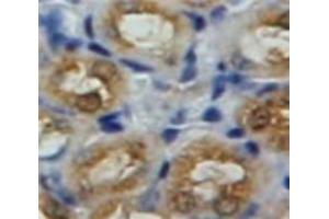 Used in DAB staining on fromalin fixed paraffin-embedded Kidney tissue (GLB1 anticorps  (AA 68-219))