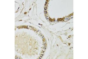 Immunohistochemistry of paraffin-embedded human breast using KLK10 Antibody. (Kallikrein 10 anticorps)