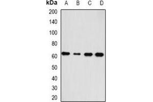 Western blot analysis of HAS3 expression in A549 (A), SKOV3 (B), mouse heart (C), rat liver (D) whole cell lysates. (HAS3 anticorps)
