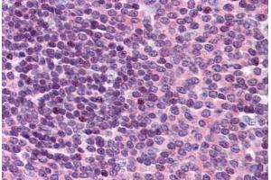 Human Spleen: Formalin-Fixed, Paraffin-Embedded (FFPE)