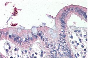 ABIN308448 (4µg/ml) staining of paraffin embedded Human Colon. (SCNN1G anticorps  (C-Term))