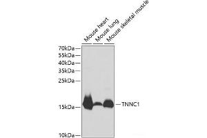 Western blot analysis of extracts of various cell lines using TNNC1 Polyclonal Antibody at dilution of 1:1000. (TNNC1 anticorps)
