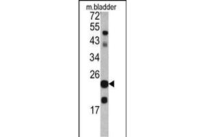 Western blot analysis of TAGLN antibody in mouse bladder tissue lysates (35ug/lane) (Transgelin anticorps  (C-Term))