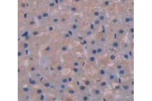 Used in DAB staining on fromalin fixed paraffin- embedded Kidney tissue (GLI1 anticorps  (AA 810-1109))