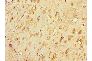Immunohistochemistry of paraffin-embedded human placenta tissue using ABIN7176684 at dilution of 1:100 (SLC3A7 (AA 162-236) anticorps)