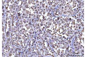IHC analysis of RNF34 using anti-RNF34 antibody (ABIN7602457).