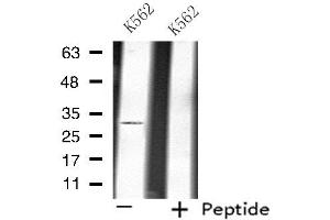 Western blot analysis of extracts from K562 cells, using ATP1B3 antibody. (ATP1B3 anticorps  (Internal Region))