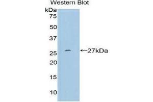 Western Blotting (WB) image for anti-SP100 Nuclear Antigen (SP100) (AA 261-465) antibody (ABIN1860601) (SP100 anticorps  (AA 261-465))