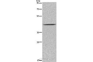 Western blot analysis of Mouse liver tissue, using JMJD6 Polyclonal Antibody at dilution of 1:800