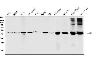 Western blot analysis of ASS1 using anti-ASS1 antibody (ABIN7601190).