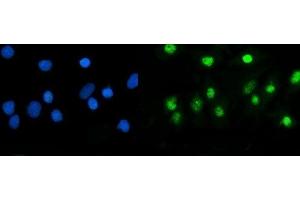 IF analysis of USP5 using anti-USP5 antibody (ABIN7599551). (USP5 anticorps  (AA 1-800))