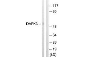 Western blot analysis of extracts from HuvEc cells, using DAPK3 (Ab-265) Antibody. (DAPK3 anticorps  (AA 241-290))