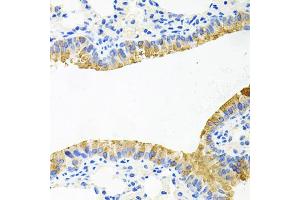 Immunohistochemistry of paraffin-embedded mouse lung using TOB2 antibody. (TOB2 anticorps)