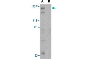 Western blot analysis of TSC2 in L1210 cell lysate with TSC2 polyclonal antibody  at 1 ug/mL in the (A) absence and (B) presence of blocking peptide. (Tuberin anticorps  (C-Term))