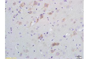Formalin-fixed and paraffin embedded rat brain tissue labeled with Anti-SCD1 Polyclonal Antibody, Unconjugated (ABIN704111) at 1:200 followed by conjugation to the secondary antibody and DAB staining (SCD anticorps  (AA 265-359))