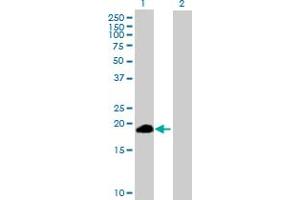 Western Blot analysis of ZSCAN1 expression in transfected 293T cell line by ZSCAN1 MaxPab polyclonal antibody. (ZSCAN1 anticorps  (AA 1-178))