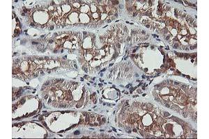 Immunohistochemical staining of paraffin-embedded Human Kidney tissue using anti-AKT1 mouse monoclonal antibody. (AKT1 anticorps)