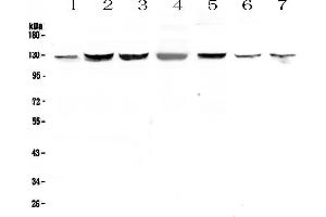 Western blot analysis of SMC6L1 using anti-SMC6L1 antibody . (SMC6 anticorps  (AA 205-443))