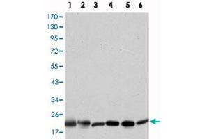 Western blot analysis using BID monoclonal antibody, clone 3C5  against HeLa (1), A-431 (2), Jurkat (3), A-549 (4), HepG2 (5), and HEK293 (6) cell lysate.