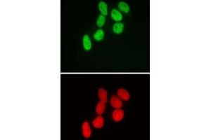 SMARCB1 antibody (mAb) (Clone 2C2) tested by immunofluorescence. (SMARCB1 anticorps)