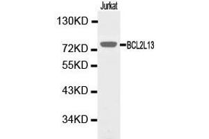 Western Blotting (WB) image for anti-BCL2-Like 13 (Apoptosis Facilitator) (BCL2L13) antibody (ABIN1871257)