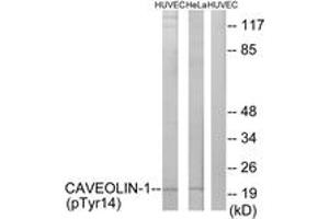 Western blot analysis of extracts from HuvEc cells treated with PMA 125ng/ml 30' and HeLa cells treated with LPS 100ng/ml 30', using Caveolin-1 (Phospho-Tyr14) Antibody. (Caveolin-1 anticorps  (pTyr14))