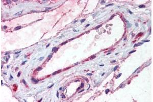 Human Testis, Vessels (formalin-fixed, paraffin-embedded) stained with ADAMTS1 antibody ABIN292613 at 20 ug/ml followed by biotinylated goat anti-rabbit IgG secondary antibody ABIN481713, alkaline phosphatase-streptavidin and chromogen. (ADAMTS1 anticorps  (Internal Region))