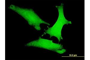 Immunofluorescence of monoclonal antibody to AXIN1 on HeLa cell.