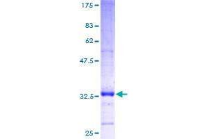 Image no. 1 for Echinoderm Microtubule Associated Protein Like 4 (EML4) (AA 1-62) protein (GST tag) (ABIN1352761)