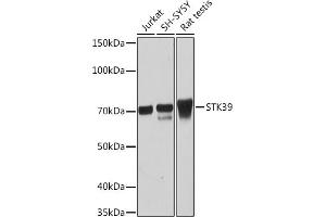 Western blot analysis of extracts of various cell lines, using STK39 Rabbit mAb (ABIN1682890, ABIN3015922, ABIN3015923 and ABIN7101461) at 1:1000 dilution. (STK39 anticorps)