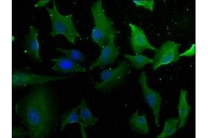 Immunofluorescence staining of U251 cells with ABIN7157870 at 1:50, counter-stained with DAPI.