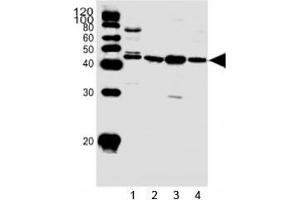 Western blot analysis of lysate from 1) HepG2 cell line and human 2) heart, 3) skeletal muscle, 4) kidney tissue using SPHK1 antibody at 1:1000.
