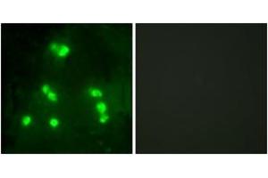 Immunofluorescence analysis of A549 cells, using HAIR Antibody. (Hairless anticorps  (AA 41-90))