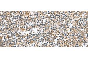 Immunohistochemistry of paraffin-embedded Human tonsil tissue using DNPH1 Polyclonal Antibody at dilution of 1:60(x200) (RCL anticorps)