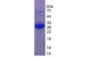 SDS-PAGE analysis of Mouse Laminin alpha 2 Protein. (Laminin Protéine)