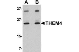 Western blot analysis of THEM4 in human liver tissue lysate with this product at (A) 1 and (B) 2 μg/ml. (THEM4 anticorps  (Center))