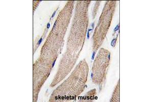 Formalin-fixed and paraffin-embedded human skeletal muscle tissue reacted with MAP2K5 Antibody (S149) , which was peroxidase-conjugated to the secondary antibody, followed by DAB staining.