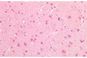 Detection of Slit3 in Human Cortex of Kidney Tissue using Polyclonal Antibody to Slit Homolog 3 (Slit3)