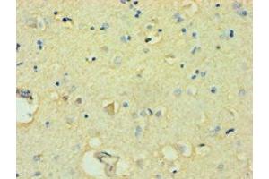 Immunohistochemistry of paraffin-embedded human brain tissue using ABIN7152490 at dilution of 1:100 (FBXW11 anticorps  (AA 1-140))