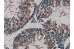 Detection of TFR2 in Mouse Testis Tissue using Polyclonal Antibody to Transferrin Receptor 2 (TFR2)