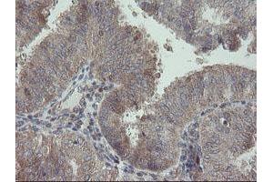 Image no. 2 for anti-Receptor (TNFRSF)-Interacting serine-threonine Kinase 1 (RIPK1) (AA 133-422) antibody (ABIN1490909)