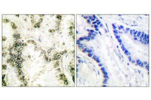 Immunohistochemistry (IHC) image for anti-X-Ray Repair Complementing Defective Repair in Chinese Hamster Cells 6 (XRCC6) (C-Term) antibody (ABIN1848653) (XRCC6 anticorps  (C-Term))