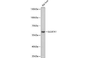 Western blot analysis of extracts of rat liver, using SLC47 antibody (4559) at 1:1000 dilution. (SLC47A1 anticorps  (AA 460-550))