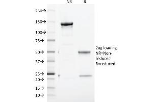 SDS-PAGE Analysis Purified CD71 Mouse Monoclonal Antibody (TFRC/1817).