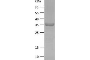 Eukaryotic Translation Initiation Factor 1A, Y-Linked (EIF1AY) (AA 1-144) protein (His-IF2DI Tag)