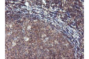 Image no. 1 for anti-Tubby Like Protein 3 (TULP3) antibody (ABIN1501583)