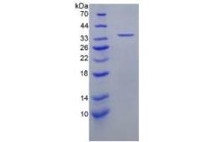 SDS-PAGE of Protein Standard from the Kit  (Highly purified E. (CXCL5 Kit ELISA)